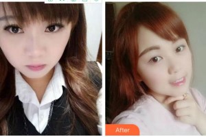 金華周亞軍口腔門診部鄒多宏整形價(jià)格表附牙齒隱形矯正案例展示