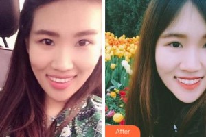 金華周亞軍口腔門診部金志平整形價(jià)格表附牙齒隱形矯正案例展示