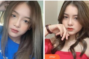 衢州芘麗芙整形美容醫(yī)院趙俊整形價(jià)格表附眼部綜合案例展示