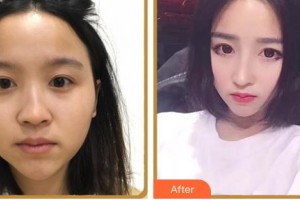 臺(tái)州市博愛醫(yī)院整形美容科唐毅整形價(jià)格表附鼻部綜合案例展示