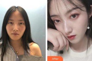 臺(tái)州骨傷醫(yī)院整形美容科張靈芝整形價(jià)格表附鼻部綜合案例展示