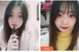 臺州拜博口腔醫(yī)院王學(xué)俠整形價(jià)格表附牙齒隱形矯正案例展示