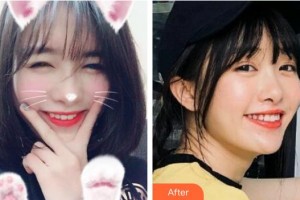 臺州拜博口腔醫(yī)院趙大鵬整形價(jià)格表附冷光美白案例展示