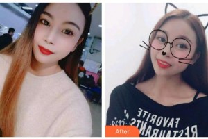 臺州康貝佳口腔醫(yī)院趙承煥整形價(jià)格表附牙貼面案例展示