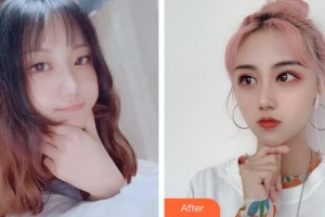 臺州國際眼科醫(yī)院江秋若住院醫(yī)師整形價(jià)格表附眼部綜合案例展示