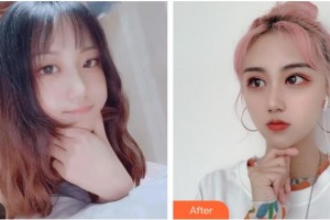 臺州國際眼科醫(yī)院宋慧洋整形價(jià)格表附眼部綜合案例展示