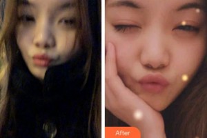 臺(tái)州康貝佳口腔醫(yī)院張俊飛整形價(jià)格表附牙齒隱形矯正案例展示