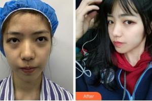 麗水思齊整形外科門(mén)診部BrianKinney整形價(jià)格表附埋線提升案例展示