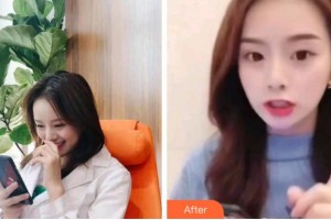 四川大學(xué)華西口腔醫(yī)院美容中心黃俊整形價(jià)格表附超聲波潔牙案例展示