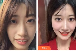 自貢維樂新橋口腔門診部陳琳整形價(jià)格表附牙齒陶瓷矯正案例展示