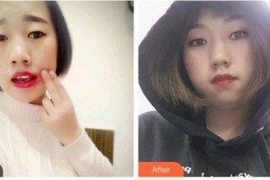 攀枝花博愛門診部楊軍整形價(jià)格表附口腔矯正案例展示