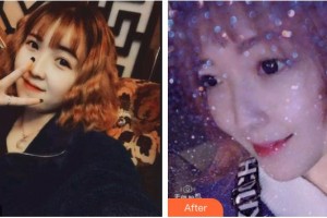 德陽維樂新橋口腔門診部孫玉楓整形價格表附超聲波潔牙案例展示