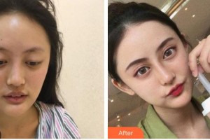 綿陽東美奧拉克醫(yī)療美容門診部黃國強(qiáng)整形價(jià)格表附鼻部綜合案例展示