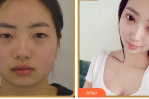 內(nèi)江韓美醫(yī)療美容門診部趙君海整形價格表附眼部綜合案例展示