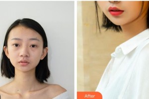 樂山金手指醫(yī)學(xué)美容診所岑曉勇整形價格表附鼻部綜合案例展示