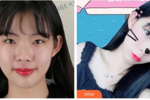 南充中心醫(yī)院整形美容外科田超整形價(jià)格表附熱瑪吉案例展示