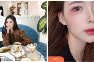 南充嬌美傾城醫(yī)學(xué)美容門(mén)診部張偉整形價(jià)格表附眼部綜合案例展示