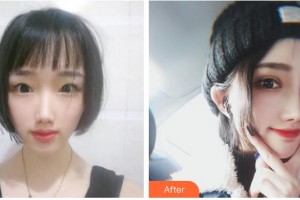 南充五星美容整形門(mén)診部唐雨珍整形價(jià)格表附切開(kāi)雙眼皮案例展示