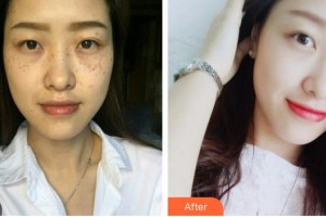 南充嬌美傾城醫(yī)學(xué)美容門(mén)診部劉曉春整形價(jià)格表附鐳射凈膚案例展示