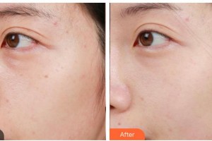 南充嬌美傾城醫(yī)學(xué)美容門(mén)診部王健整形價(jià)格表附激光美膚激光案例展示