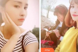 南充華醫(yī)口腔醫(yī)院周華微整形價(jià)格表附美白貼片案例展示