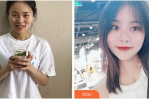 眉山華信醫(yī)學(xué)整形美容醫(yī)院金碩正整形價(jià)格表附開內(nèi)眼角案例展示