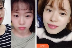 眉山仁壽星辰醫(yī)療美容門診部李亮整形價(jià)格表附眼部綜合案例展示