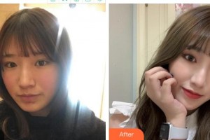 宜賓華膚皮膚病醫(yī)院顧昌林整形價格表附光子嫩膚案例展示