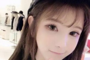 武漢伽美醫(yī)療美容醫(yī)院朱富初整形價格表附激光點痣案例展示