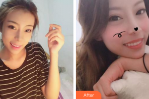 佛山市禪城區(qū)人民醫(yī)院口腔專(zhuān)科醫(yī)院關(guān)達(dá)榮整形價(jià)格表附隱形矯正案例展示