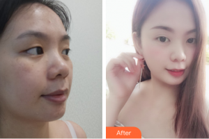 湛江市第一中醫(yī)院整形美容中心萬敏整形價格表附無針?biāo)獍咐故?>
</a>
<h3 class=