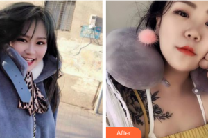 湛江市第一中醫(yī)院整形美容中心趙璽耀整形價格表附水氧活膚案例展示