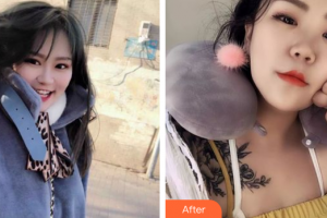 湛江東盟整形美容醫(yī)院林希瞳整形價格表附水氧活膚案例展示