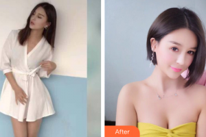 茂名華美整形美容醫(yī)院付炳根整形價(jià)格表附自體脂肪隆胸案例展示