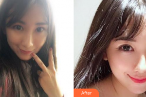 肇慶市皮膚病醫(yī)院醫(yī)療美容科陳潔華整形價(jià)格表附光子嫩膚案例展示