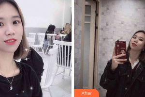 肇慶市皮膚病醫(yī)院醫(yī)療美容科劉珍華整形價格表附超微小氣泡案例展示