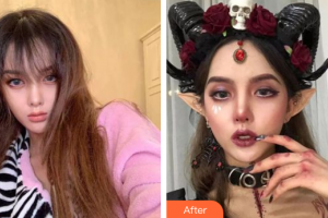 肇慶中大口腔醫(yī)院趙婉寧整形價格表附冷光美白案例展示