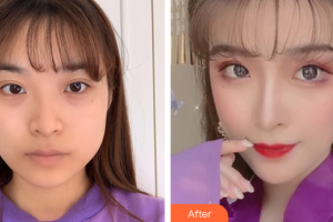 東莞瑞芙臣醫(yī)療美容門(mén)診部樸埈奎整形價(jià)格表附下頜角磨骨案例展示