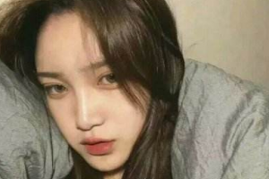 鄭州帝爾美整形美容醫(yī)院劉清波整形價格表附切開雙眼皮案例展示