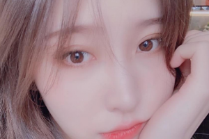 武漢華亞美容醫(yī)院張思雄整形價(jià)格表附清潔祛痘案例展示