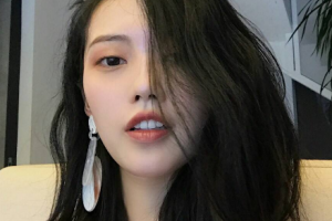 武漢美基元醫(yī)療美容醫(yī)院盛敏蘭整形價(jià)格表附激光祛斑案例展示