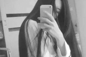 廣東藥學(xué)院附屬第一醫(yī)院激光整形美容外科惠俐整形價(jià)格表附紅藍(lán)光祛痘案例展示