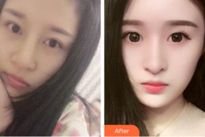 河南省軍區(qū)醫(yī)院激光美容中心姬瑜   整形價(jià)格表附皮膚美容案例展示