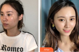 河南大學(xué)附屬南石醫(yī)院燒傷整形美容中心徐文舉整形價(jià)格表附皮膚美容案例展示