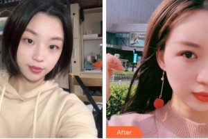 河南整形美容醫(yī)院魯華整形價格表附眼部手術(shù)案例展示