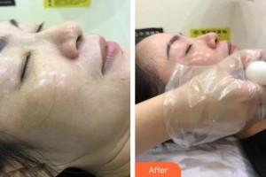 湖北武警總隊(duì)醫(yī)院醫(yī)學(xué)美容中心謝艾玲整形價(jià)格表附補(bǔ)水保濕案例展示