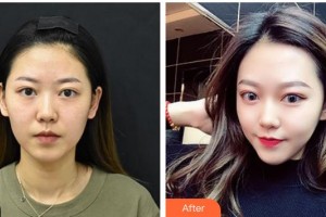 云南華美美萊美容醫(yī)院余龍整形價格表附光子嫩膚案例展示