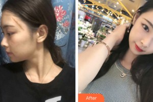 海南整形美容醫(yī)院馬文熙教授，整形價(jià)格表附皮膚美容案例展示