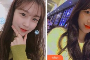 云南華美美萊美容醫(yī)院楊繼紅整形價格表附埋線雙眼皮案例展示