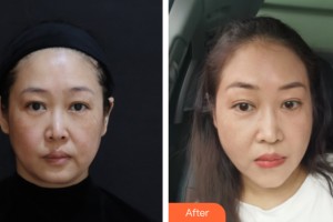 海南夢(mèng)妮幻整形?？崎T(mén)診部何濤整形價(jià)格表附皮膚美容案例展示